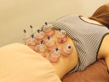 カッピング施術