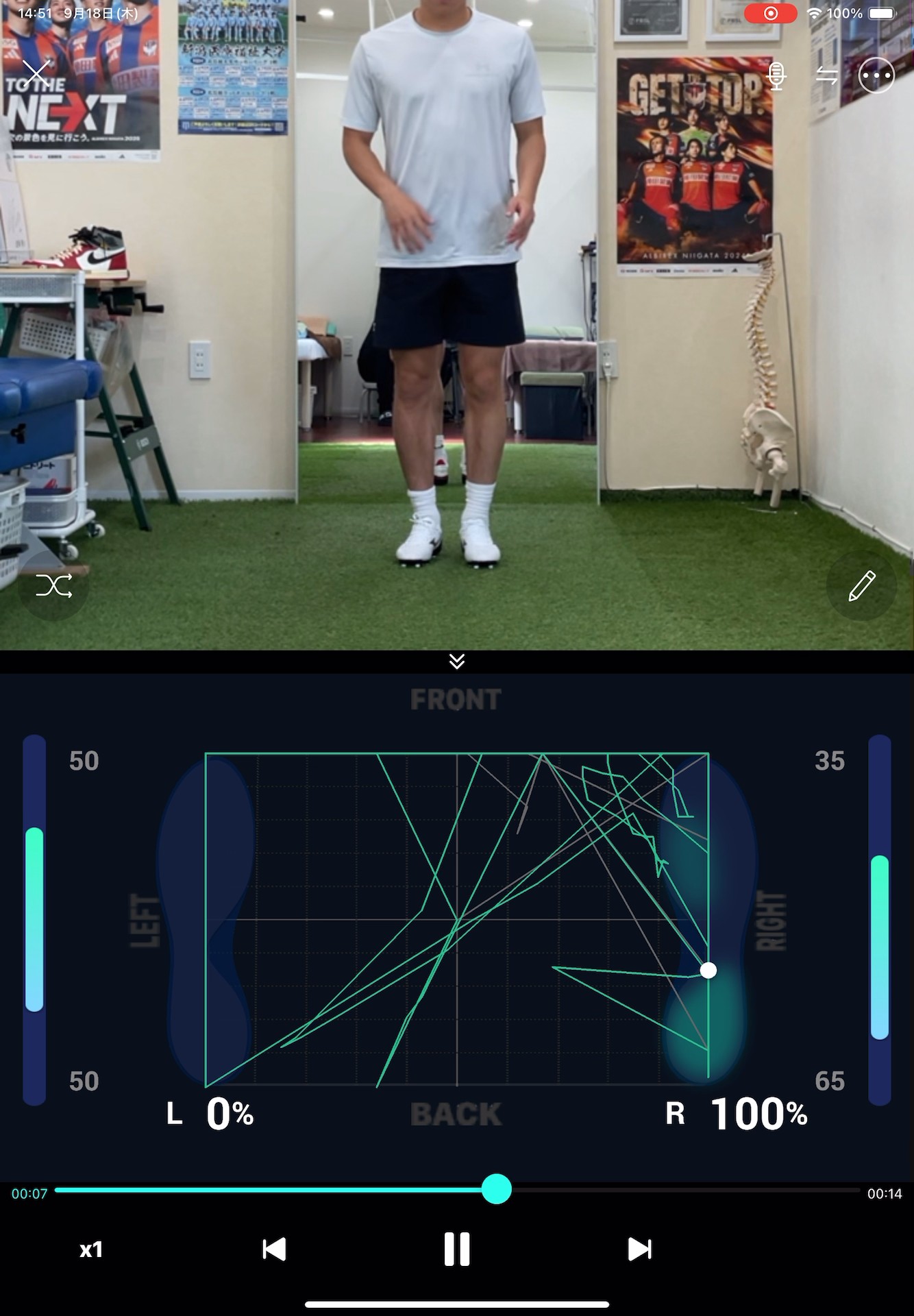 動作解析システム